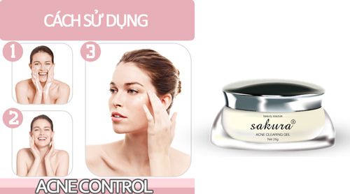 kem trị mụn sakura acne gel